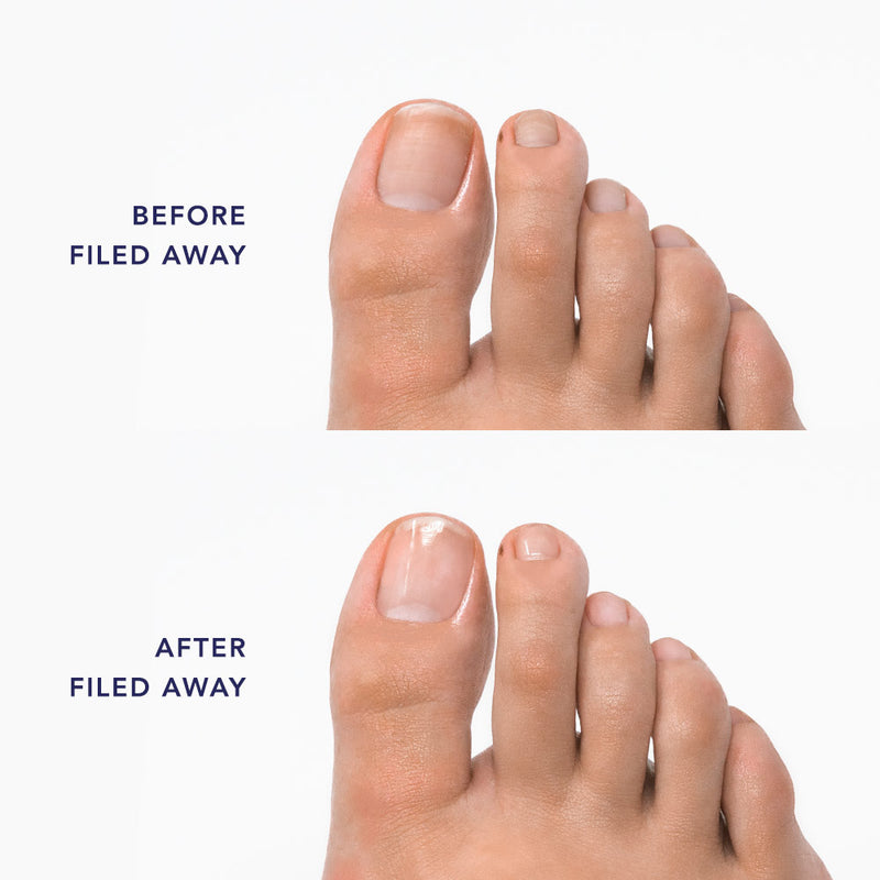  Heal A Heel NanoGlass Foot File